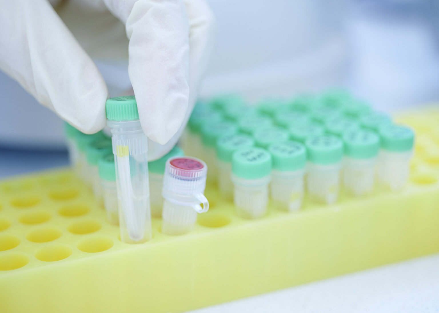 Dermatophyten – Diagnostik von Haut- und Fußpilz