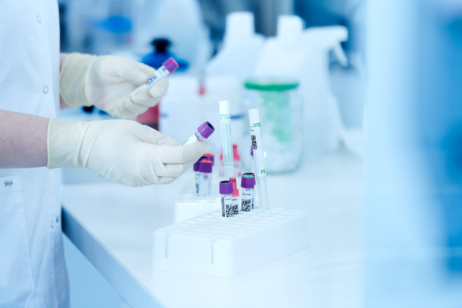 Test auf hereditäre Fruktoseintoleranz – genetische Analyse