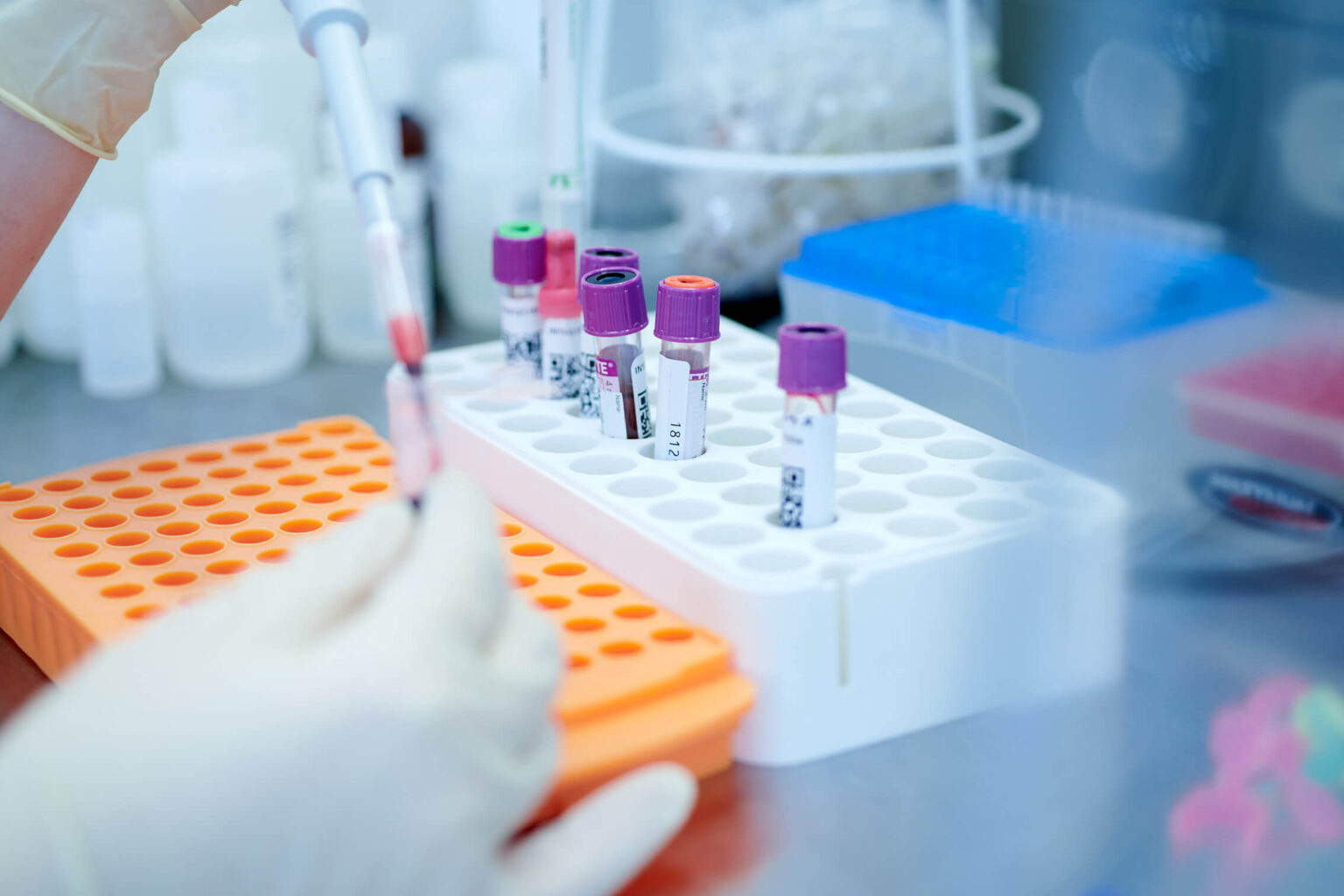 Unverträglichkeitsanalyse FOX – Nahrungsmittelantigene im Labor