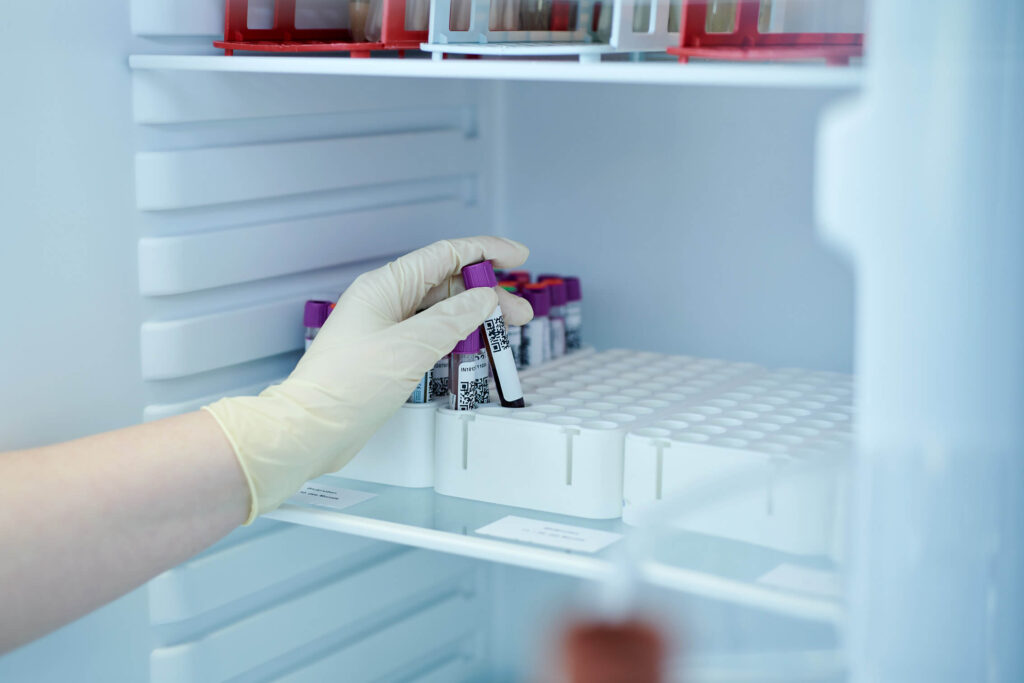 Test auf Laktoseintoleranz – genetische Analyse im Labor