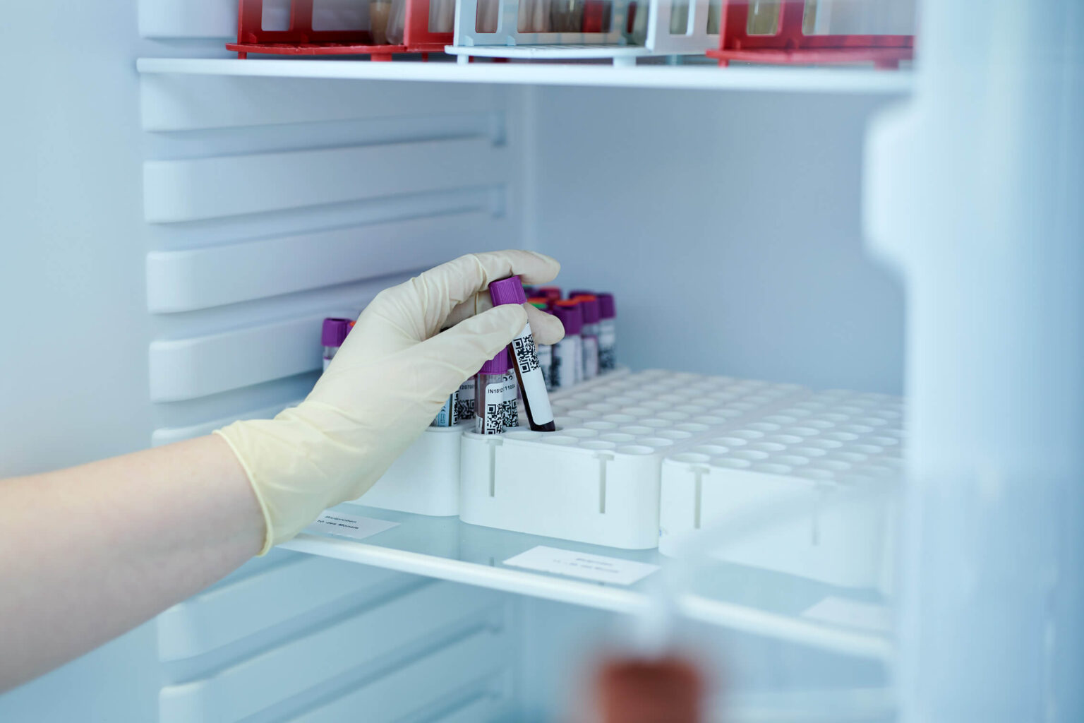 Test auf Laktoseintoleranz – genetische Analyse im Labor