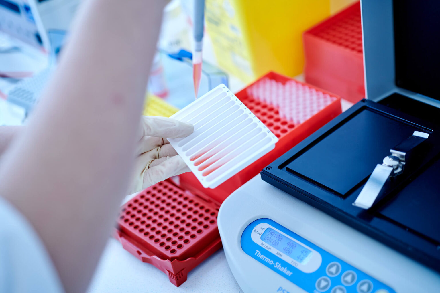 Faktor-V-Leiden-Mutation – genetische Laboranalyse