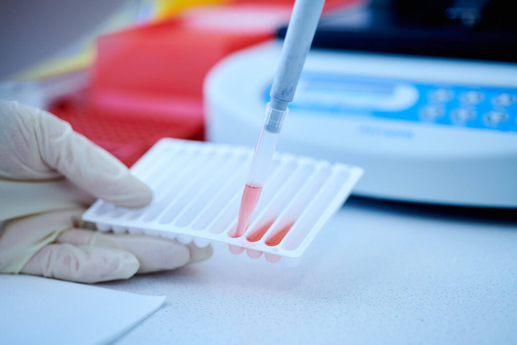 Prothrombinmutation G20210A – genetische Laboranalyse